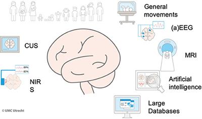 Precision Medicine in Neonates: A Tailored Approach to Neonatal Brain Injury